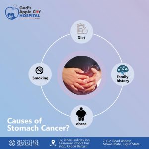 Stomach cancer