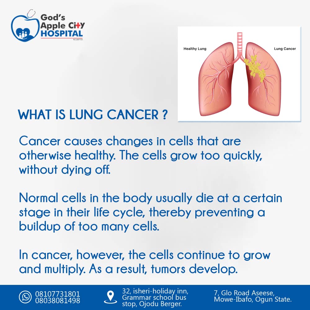 Lung Cancer