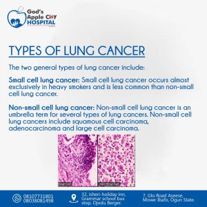 Lung Cancer