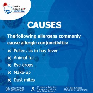 Allergic conjunctivitis 