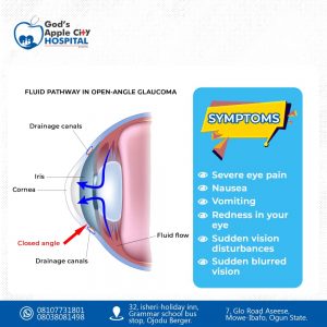 Glaucoma