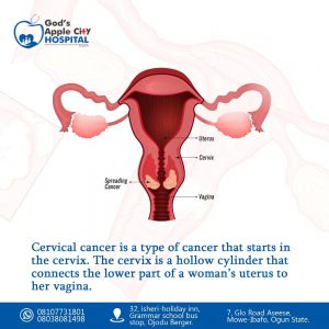 Cervical Cancer