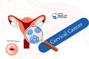 Cervical Cancer