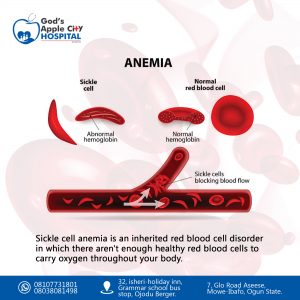 Sickle cell Anemia