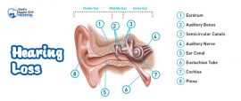 hearing loss